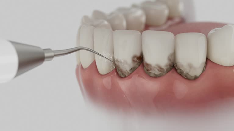 Trusted Dental Implants service in Garden City, KS - Dentist Open Now